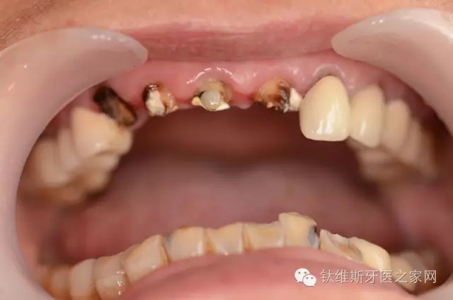 640.webp (1).jpg 640.webp (1).jpg