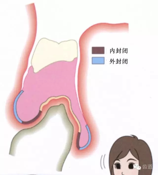 640.webp (1).jpg 640.webp (1).jpg