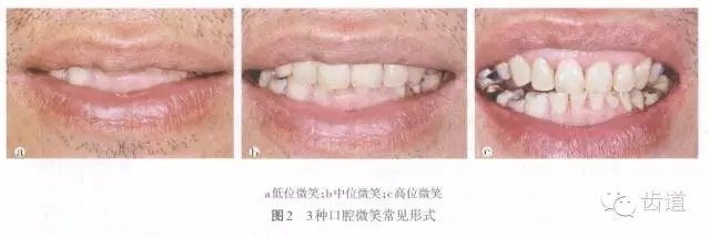 640.webp.jpg 640.webp.jpg