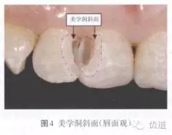 640.webp (2).jpg 640.webp (2).jpg