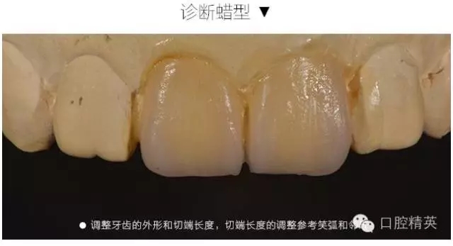 640.webp (3).jpg 640.webp (3).jpg