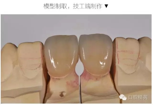 640.webp (11).jpg 640.webp (11).jpg