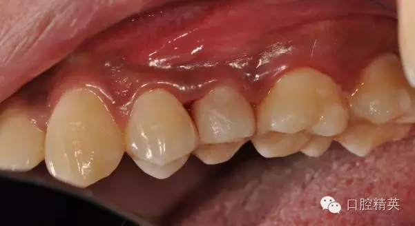 640.webp (25).jpg 640.webp (25).jpg