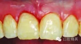 640.webp (9).jpg 640.webp (9).jpg