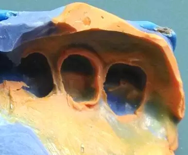 640.webp (11).jpg 640.webp (11).jpg