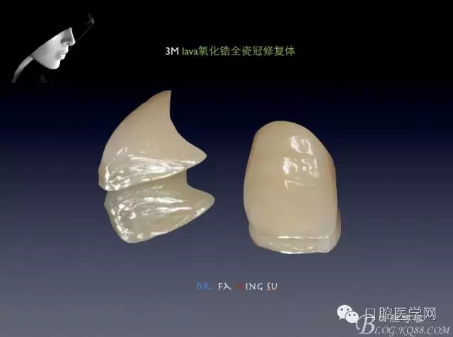 640.webp (5).jpg 640.webp (5).jpg