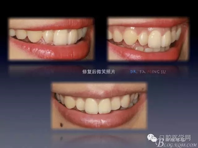 640.webp (9).jpg 640.webp (9).jpg