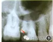 640.webp.jpg 640.webp.jpg