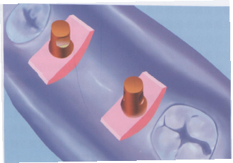 psb (8).png psb (8).png