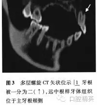 640.webp (11).jpg 640.webp (11).jpg