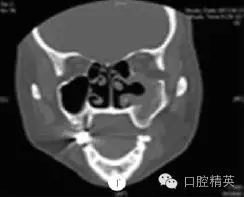 640.webp (4).jpg 640.webp (4).jpg