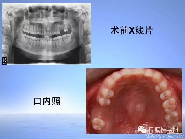 640.webp (3).jpg 640.webp (3).jpg