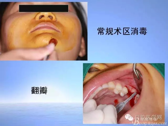 640.webp (11).jpg 640.webp (11).jpg