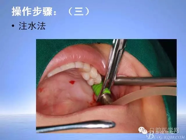 640.webp (22).jpg 640.webp (22).jpg