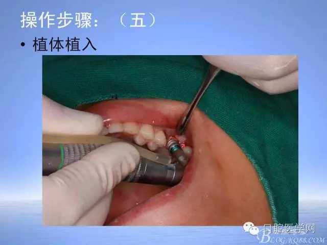 640.webp (25).jpg 640.webp (25).jpg