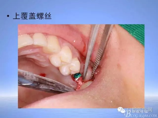 640.webp (26).jpg 640.webp (26).jpg