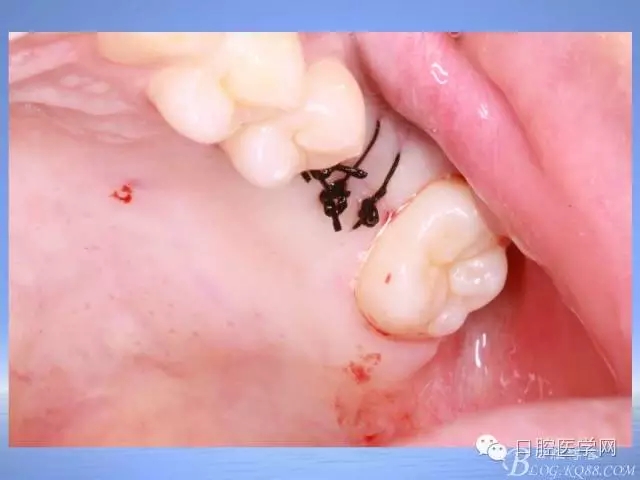 640.webp (29).jpg 640.webp (29).jpg