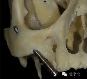 640.webp.jpg 640.webp.jpg