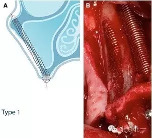 640.webp (2).jpg 640.webp (2).jpg