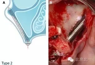 640.webp (3).jpg 640.webp (3).jpg