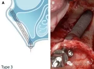 640.webp (4).jpg 640.webp (4).jpg