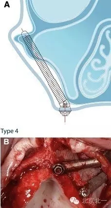 640.webp (5).jpg 640.webp (5).jpg