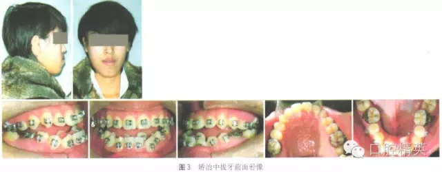 640.webp (2).jpg 640.webp (2).jpg