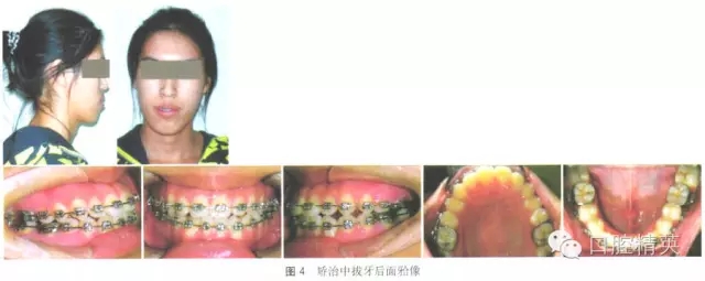 640.webp (3).jpg 640.webp (3).jpg