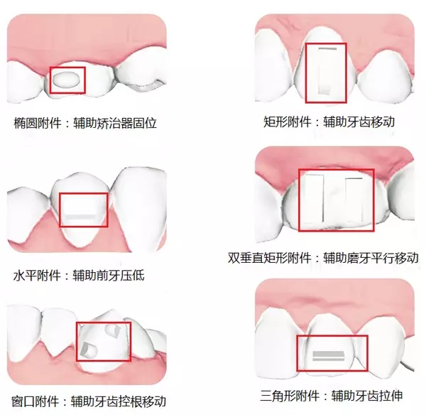 0.webp.jpg 0.webp.jpg