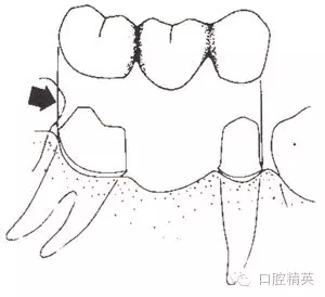 640.webp (4).jpg 640.webp (4).jpg