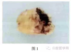 640.webp.jpg 640.webp.jpg