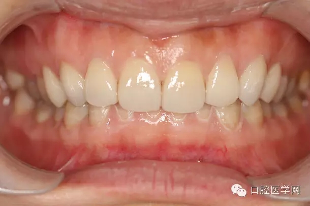 640.webp (1).jpg 640.webp (1).jpg