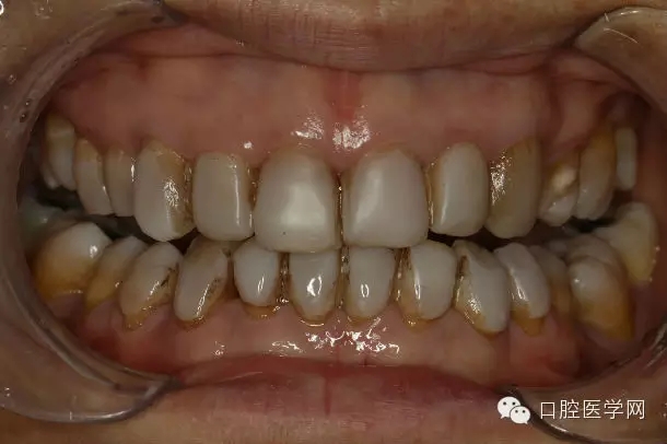 640.webp (3).jpg 640.webp (3).jpg