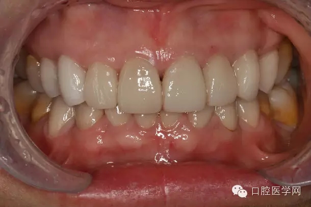 640.webp (4).jpg 640.webp (4).jpg