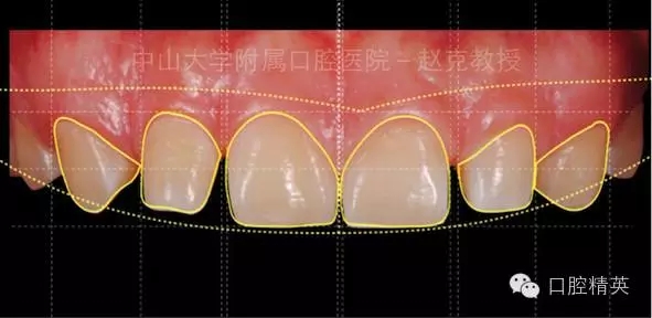 640.webp.jpg 640.webp.jpg