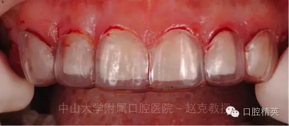 640.webp (2).jpg 640.webp (2).jpg