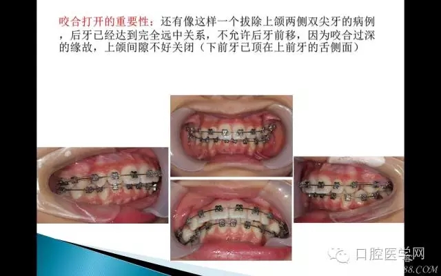 640.webp.jpg 640.webp.jpg