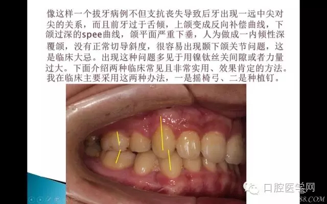 640.webp (2).jpg 640.webp (2).jpg