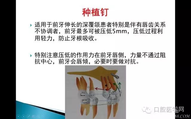 640.webp (7).jpg 640.webp (7).jpg