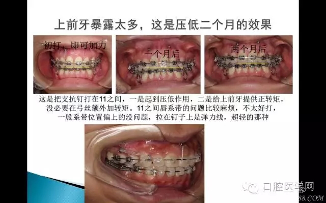 640.webp (9).jpg 640.webp (9).jpg