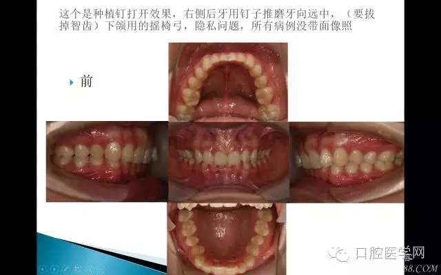 640.webp (10).jpg 640.webp (10).jpg