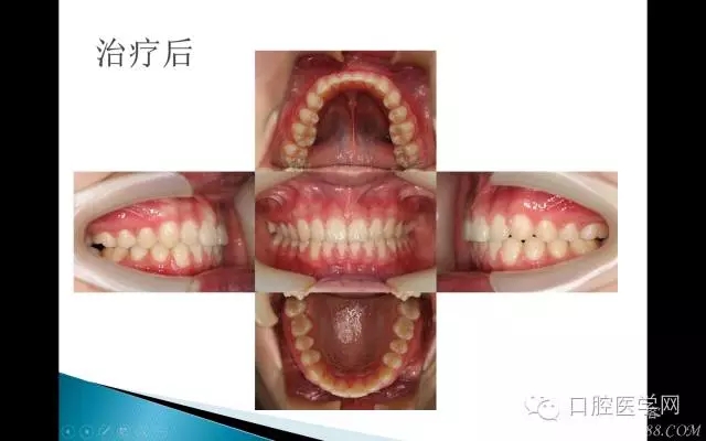 640.webp (11).jpg 640.webp (11).jpg