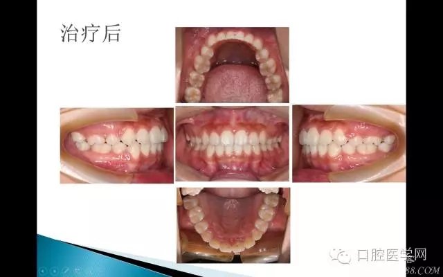 640.webp (13).jpg 640.webp (13).jpg