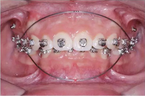 QQ圖片20161110155820.png QQ圖片20161110155820.png