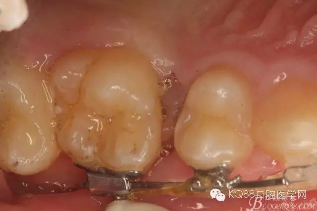 640.webp (1).jpg 640.webp (1).jpg