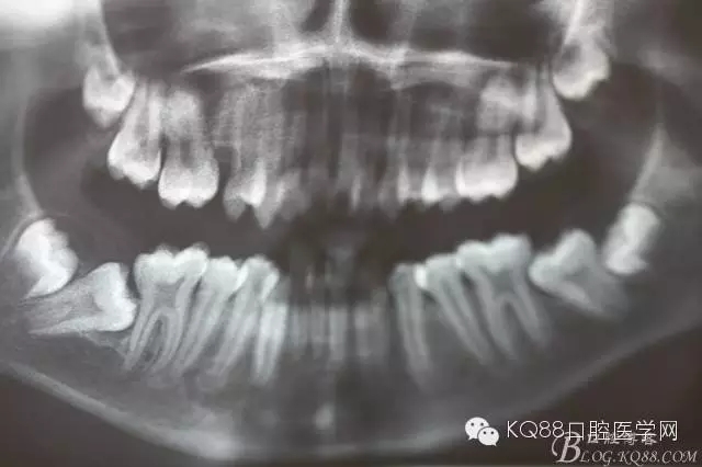 640.webp (2).jpg 640.webp (2).jpg