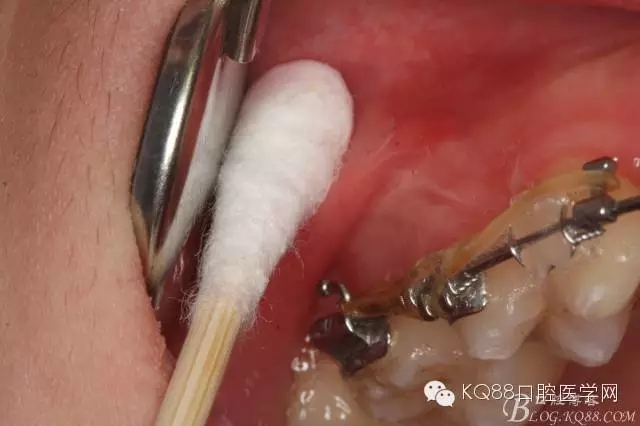 640.webp (4).jpg 640.webp (4).jpg