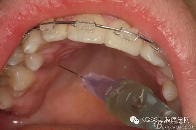 640.webp (6).jpg 640.webp (6).jpg