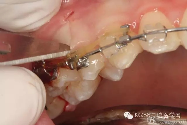 640.webp (9).jpg 640.webp (9).jpg