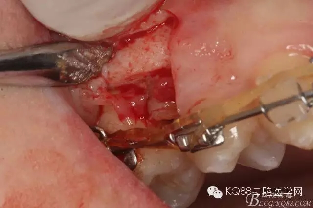 640.webp (10).jpg 640.webp (10).jpg